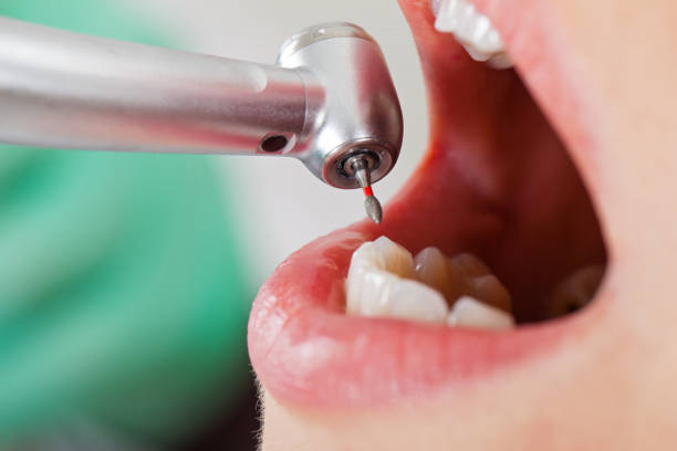Best Emergency TMJ Treatment in Orange Beach, AL